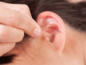 4 Razones para probar la Auriculoterapia