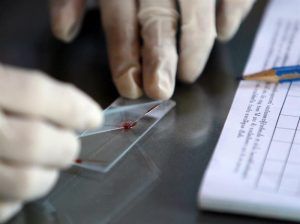 Un tipo de ferroportina puede proteger contra la malaria