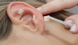 Razones para probar la Auriculoterapia