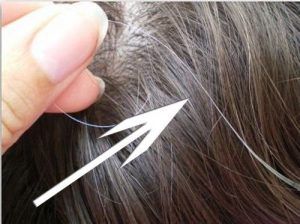 sistema inmune y canas