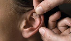 Curso de Auriculoterapia