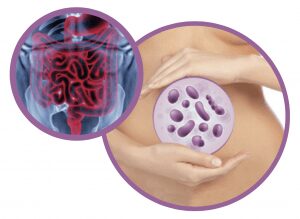bacterias intestinales influyen en la esclerosis múltiple
