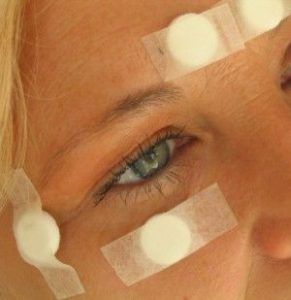 Acupuntura sin agujas con silicio cristalizado (Stiper)
